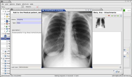 „GNU Health, informační systém ve zdravotnictví (Zdroj: health.gnu.org, CC-BY-SA)